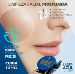 Limpieza facial con láser azul en Barcelona