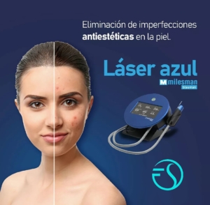 Limpieza facial con láser azul en Barcelona